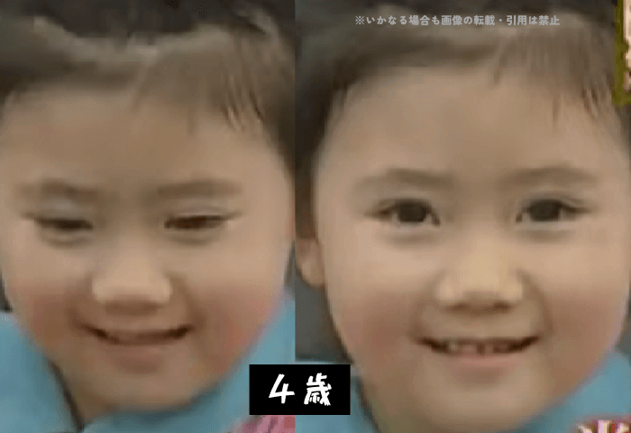 元卓球選手福原愛さんの4歳の時の画像2枚
左側画像＝うつむいている
右側画像＝正面を見ている
どちらもパッチリ二重でかわいらしい